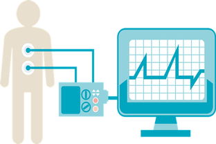取消“一品雙規”，國產高端醫療器械打破外資壟斷的技術轉讓路徑